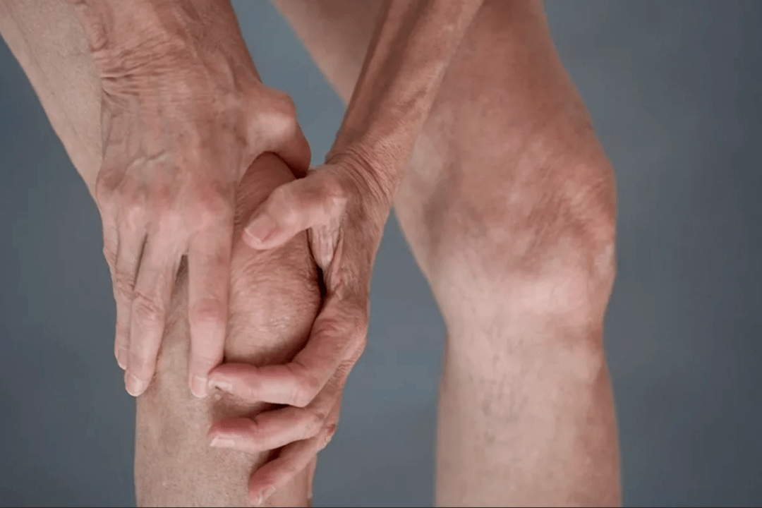 joint pain can be the cause of arthrosis or arthritis